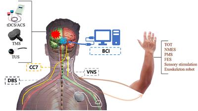 Frontiers | Editorial: Novel Technologies Targeting The Rehabilitation ...